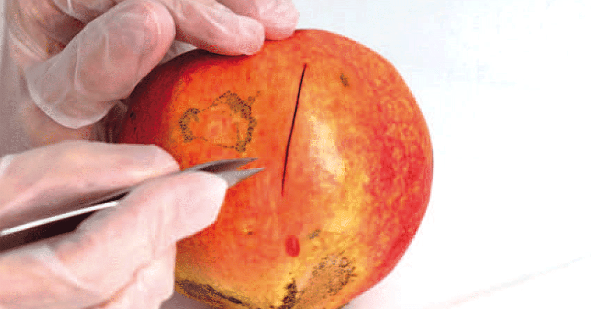 Cicatrisation des plaies exsudative, nécrosée, fibrineuse,