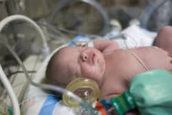 L’ANDPE soutient l’appel de l’EFCNI à la mobilisation pour la santé du nouveau-né