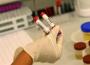 Sida: dépister 30 000 séropositifs qui s’ignorent pour endiguer l’épidémie
