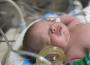 L’ANPDE soutient l’appel de l’EFCNI à la mobilisation pour la santé du nouveau-né