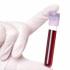 Sécurité transfusionnelle : le danger des erreurs de prélèvements