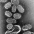 Pandémies virales : un prix Nobel de médecine critique les « scénarios catastrophes »