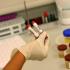 Sida: dépister 30 000 séropositifs qui s’ignorent pour endiguer l’épidémie