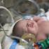 Formation des infirmiers en réanimation néonatale : l’ANPDE pointe d’importantes disparités