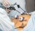 Chirurgie bariatrique : cas clinique ; prise en charge dans le cadre d’une sleeve gastrectomie chez un patient obèse
