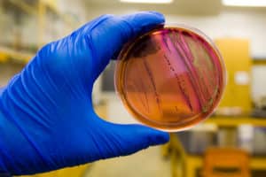 Bactéries multirésistantes: une nouvelle menace sanitaire