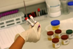 SIDA : Des tests aux urgences révèlent peu de nouveaux cas de séropositifs
