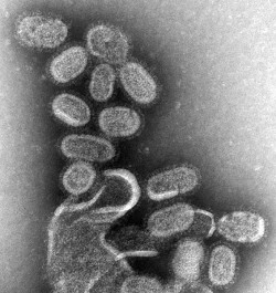 Pandémies virales : un prix Nobel de médecine critique les "scénarios catastrophes"