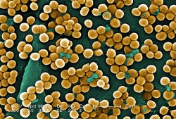 Staphylocoque doré - © Microbe World