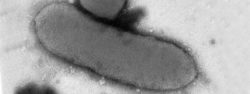 Photo en microscopie électronique à transmission en coloration négative de Rouxiella chamberiensis. © Institut Pasteur 