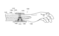 Google dépose un brevet pour un bracelet "anti-cancer"