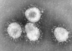 ©Centers for Disease Control and Prevention. Coronavirus au microscope électronique