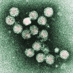 virus de l'hépatite C en microscopie électronique. © CC Flickr / AJC1 