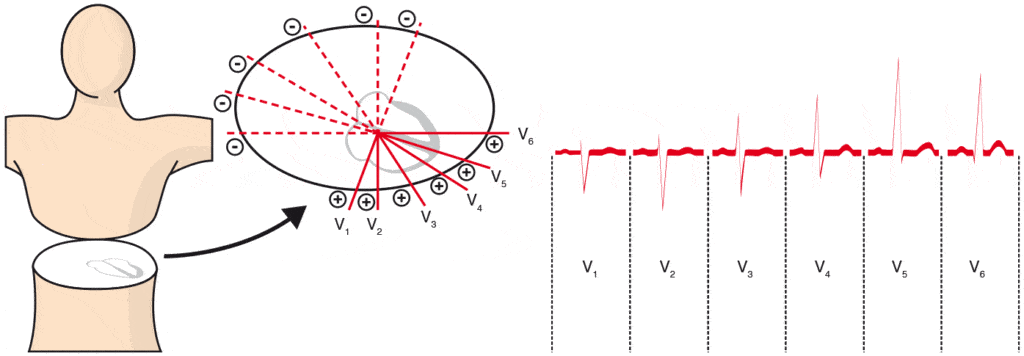 electrocardiogramme_derivation