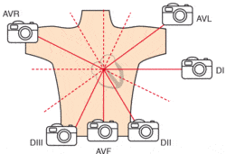 electrocardiogramme derivations