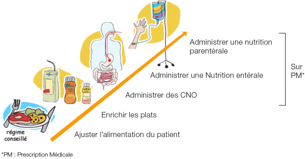 schéma de la PEC nutritionnelle