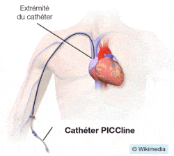 Cathéter PICCline