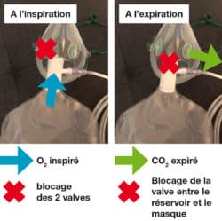 masque à haute concentration (MHC)