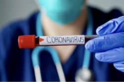 Covid-19 : des tests sérologiques dès demain en Lorraine