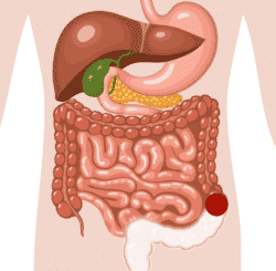 colostomie