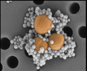 Septicémie : une protéine et un aimant pour purifier le sang Visuel@Harvard's Wyss Institute