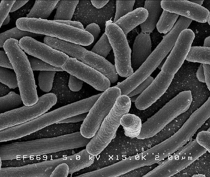 Réanimation : en 2017, un adulte sur dix a développé une infection associée à un dispositif invasif Réanimation : en 2017, un adulte sur dix a développé une infection associée à un dispositif invasif