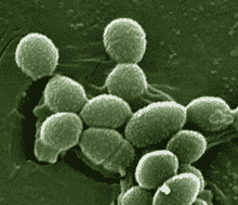 Bactérie multirésistante au CHU de Limoges