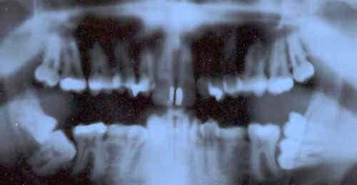 Les dentistes gâtés par les sénateurs