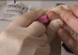 Hépatite B et C : vers la rémunération d’un acte de dépistage ?