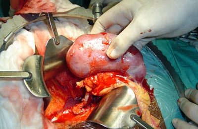 Transplantation: bientôt un réseau européen ?