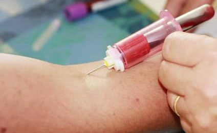 Sida : 49 contaminations professionnelles depuis le début de l’épidémie