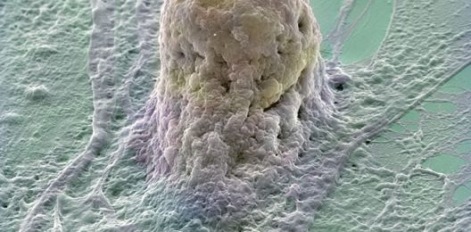 Japon: un (mini) foie créé à partir de cellules souches pluripotentes Japon: un (mini) foie créé à partir de cellules souches pluripotentes