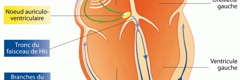 Comprendre l’ECG (électrocardiogramme), un défi osé ?