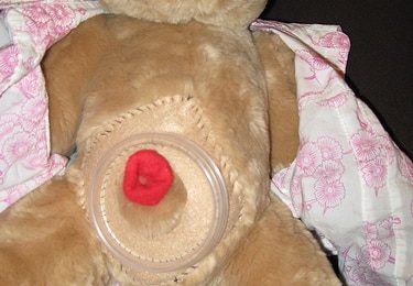 Stomathérapie : une expertise infirmière