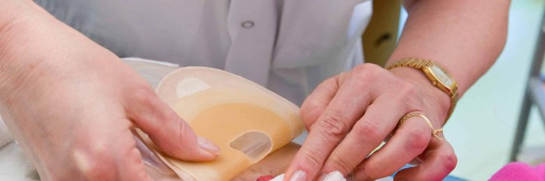 Les stomies urinaires