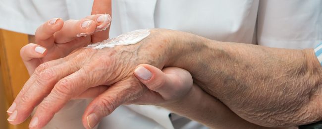 Plaies chroniques et peau péri-lésionnelle : l’intérêt des dermocosmétiques