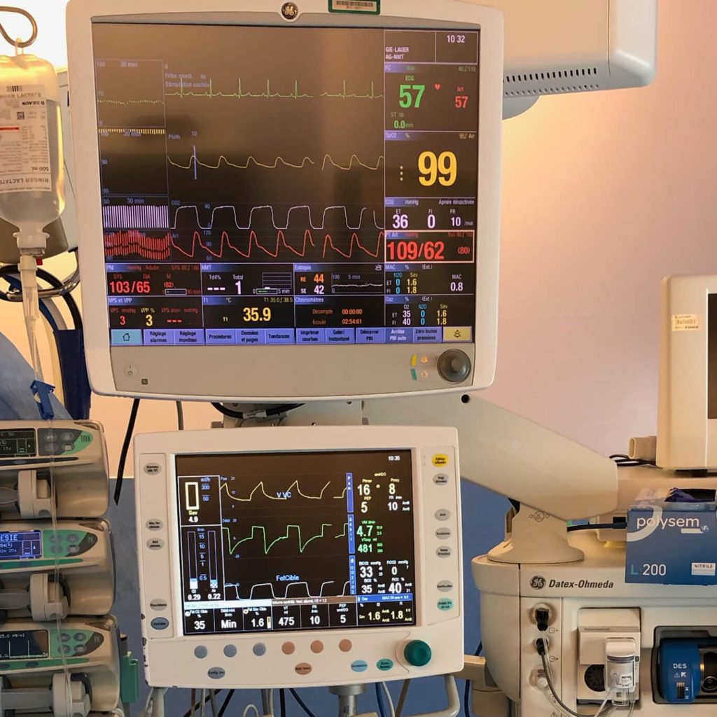 Mieux comprendre l’anesthésie générale Actusoins