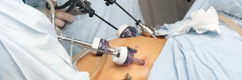 Chirurgie bariatrique : cas clinique ; prise en charge dans le cadre d’une sleeve gastrectomie chez un patient obèse