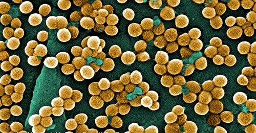 Infections nosocomiales : 4200 décès par an