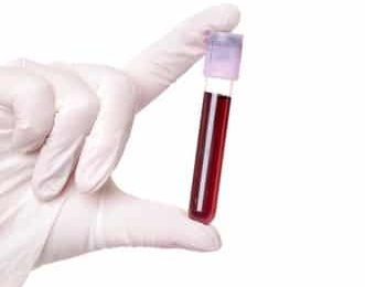 Sécurité transfusionnelle : le danger des erreurs de prélèvements