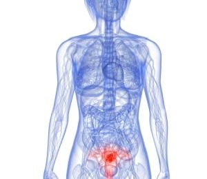 Une transplantation d’utérus mère / fille ?