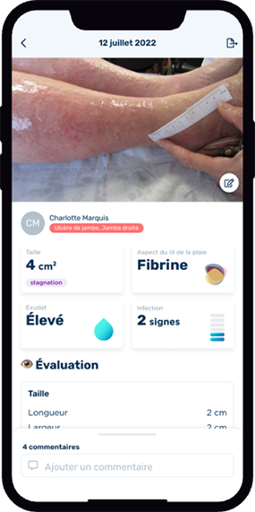 healico Une fiche récap’ de chacune de vos évaluations de plaies directement exportable en PDF