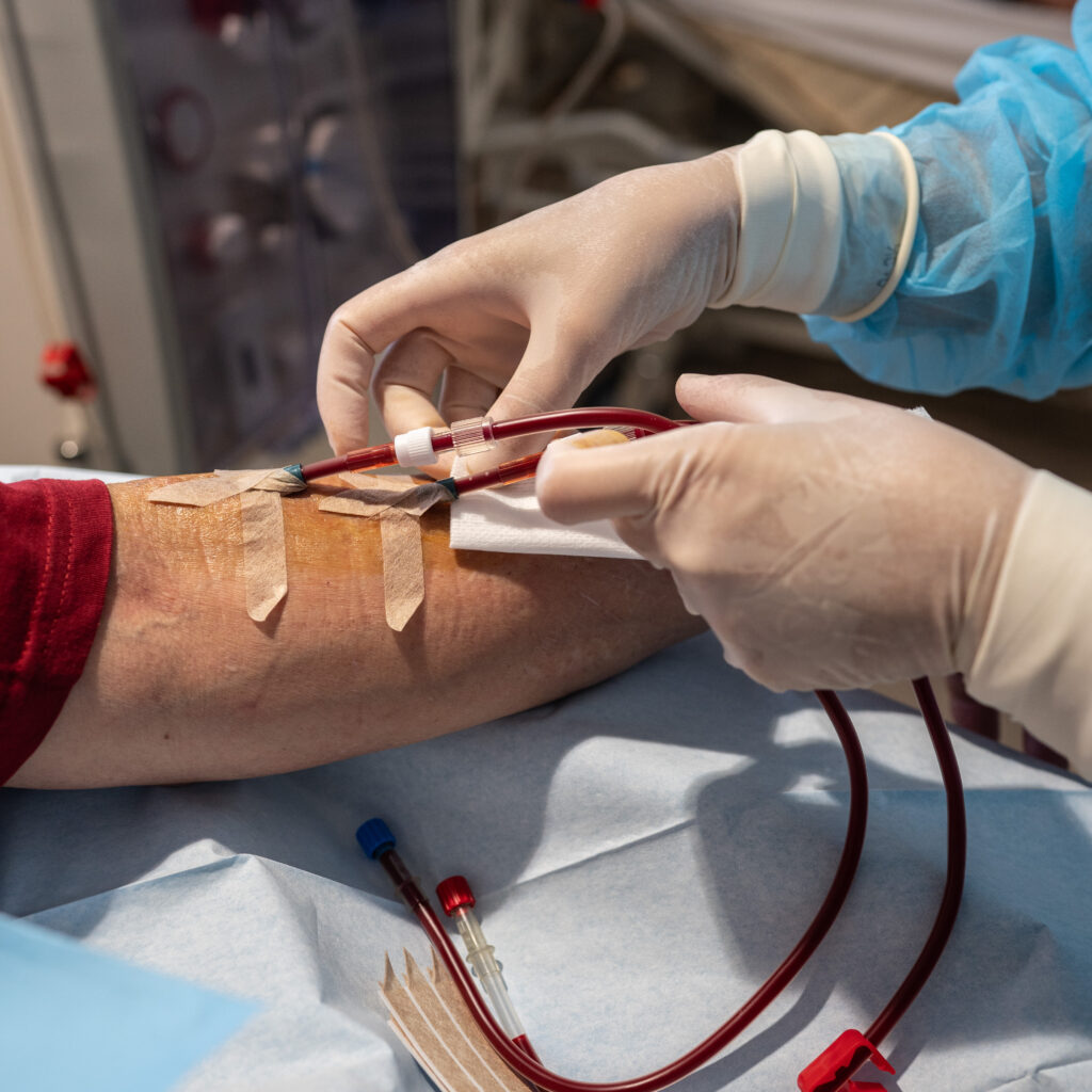 À Lyon, dans un service « lourd » d’hémodialyse